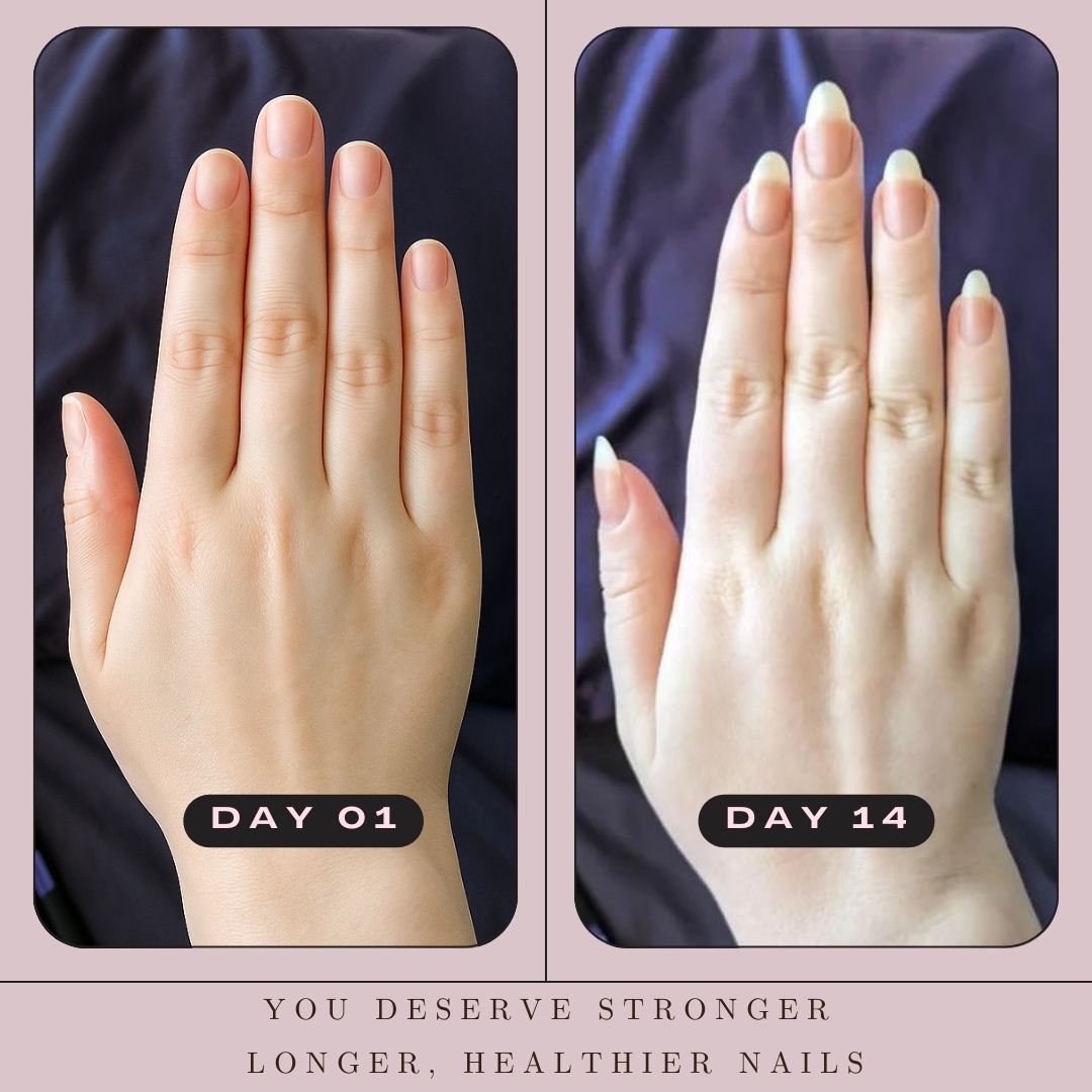 Nail Oil Pen (Cuticle's Oil)